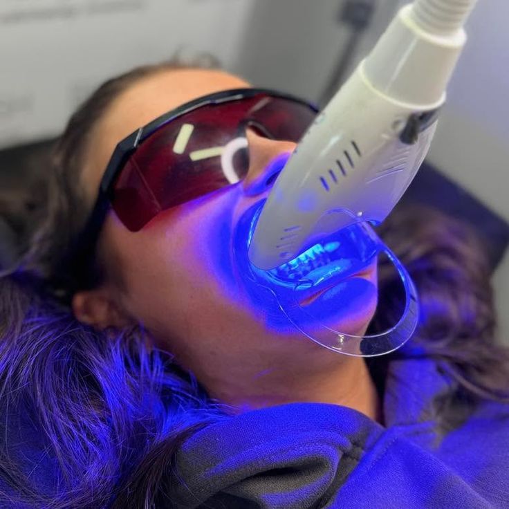 Premium Teeth Whitening