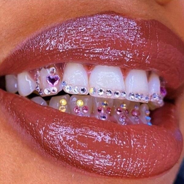 Tooth Gems
