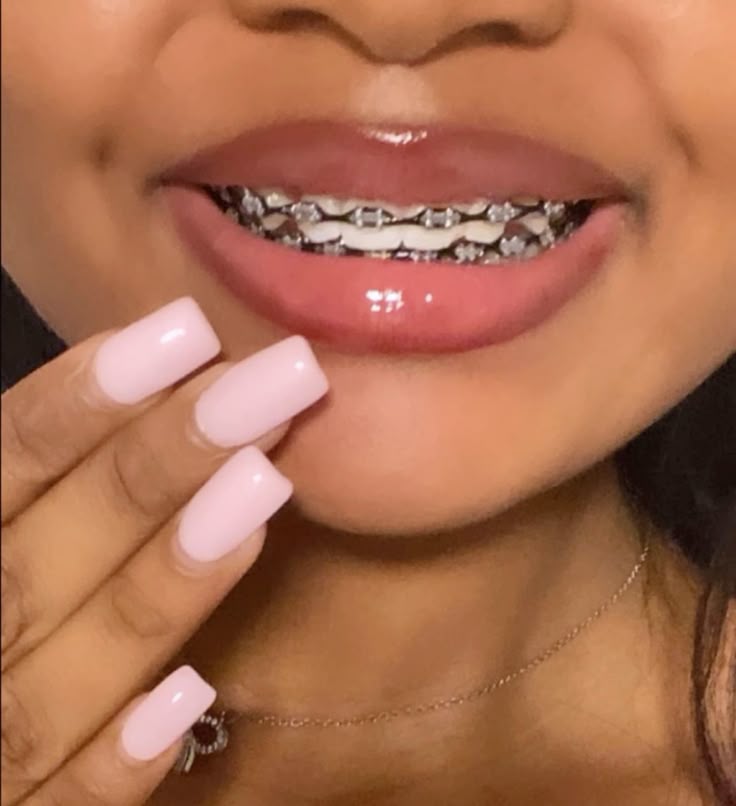 Power Chain Braces