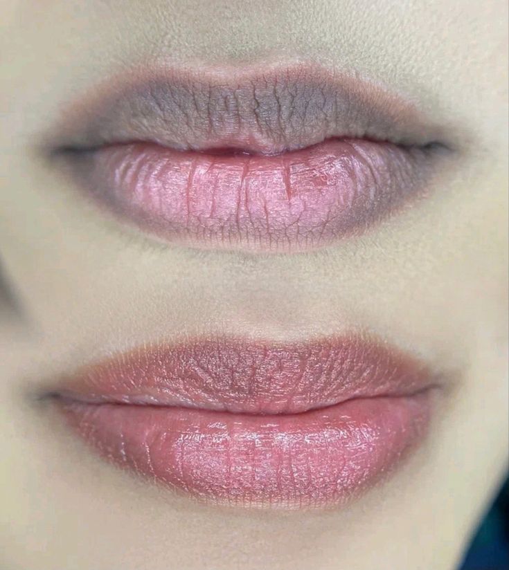 Dark Lip Neutralization