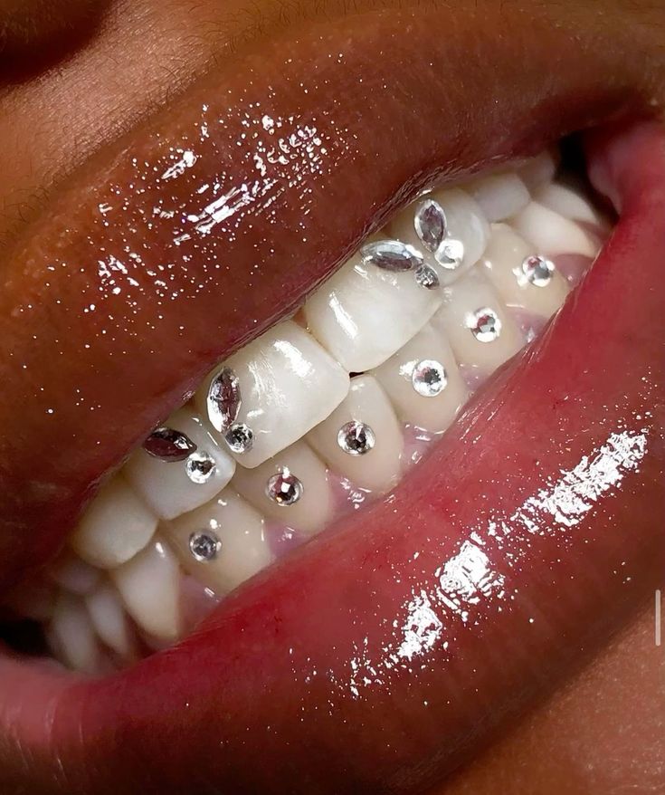 Tooth Gems