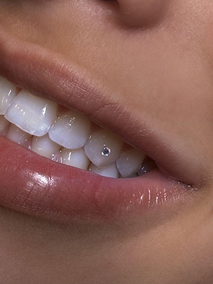 Tooth Gems